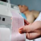 EKG Reading