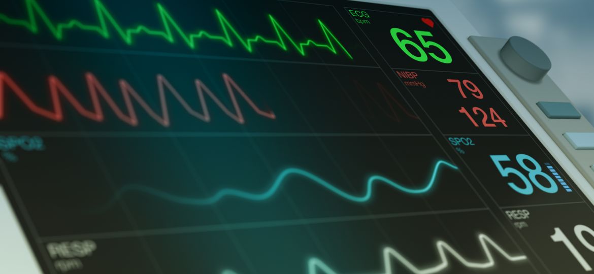 closeup view of an ecg ekg monitor on a operating room