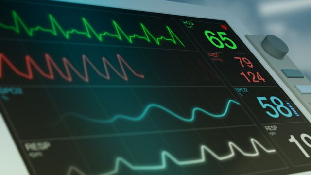 closeup view of an ecg ekg monitor on a operating room