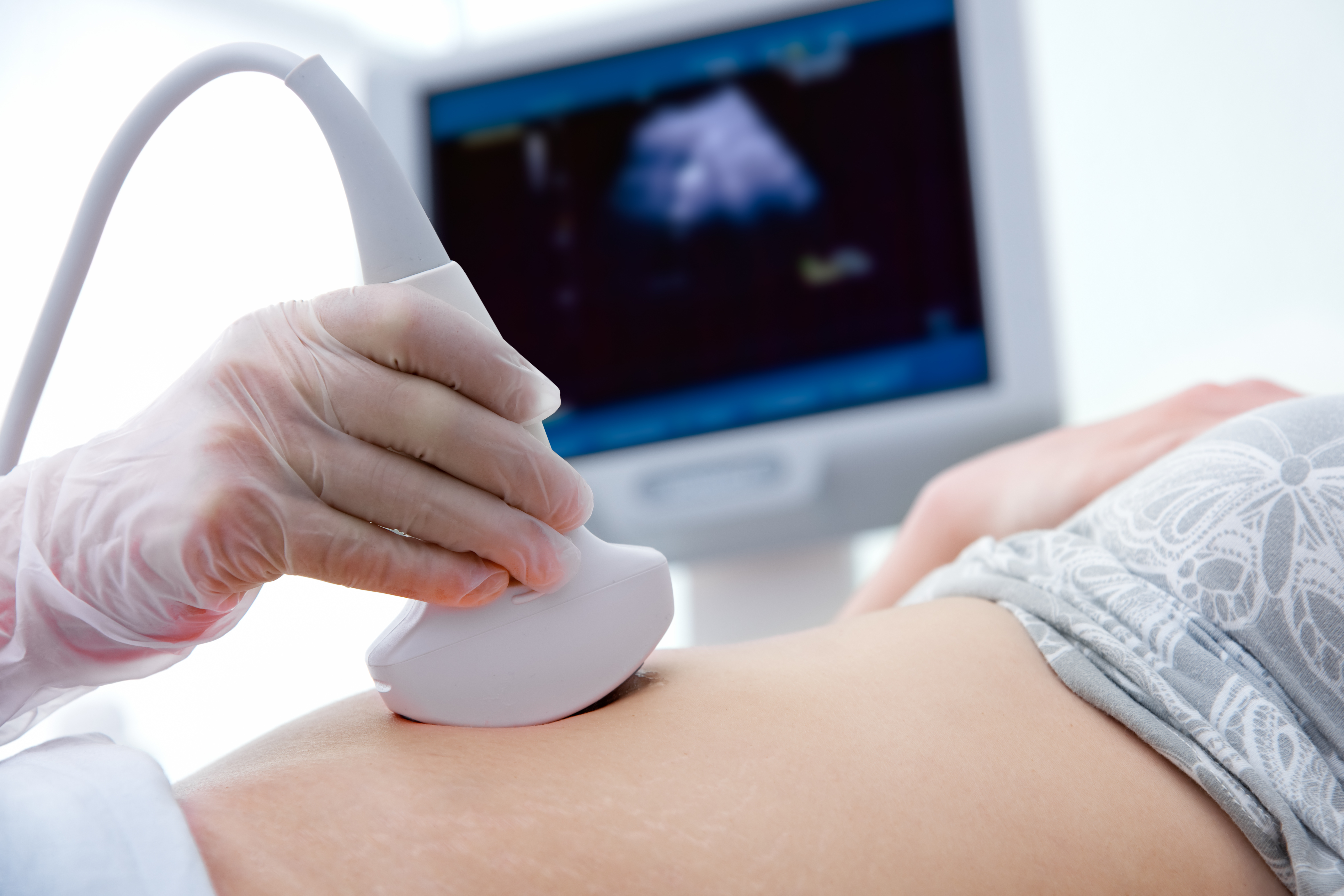 Choosing an ultrasound