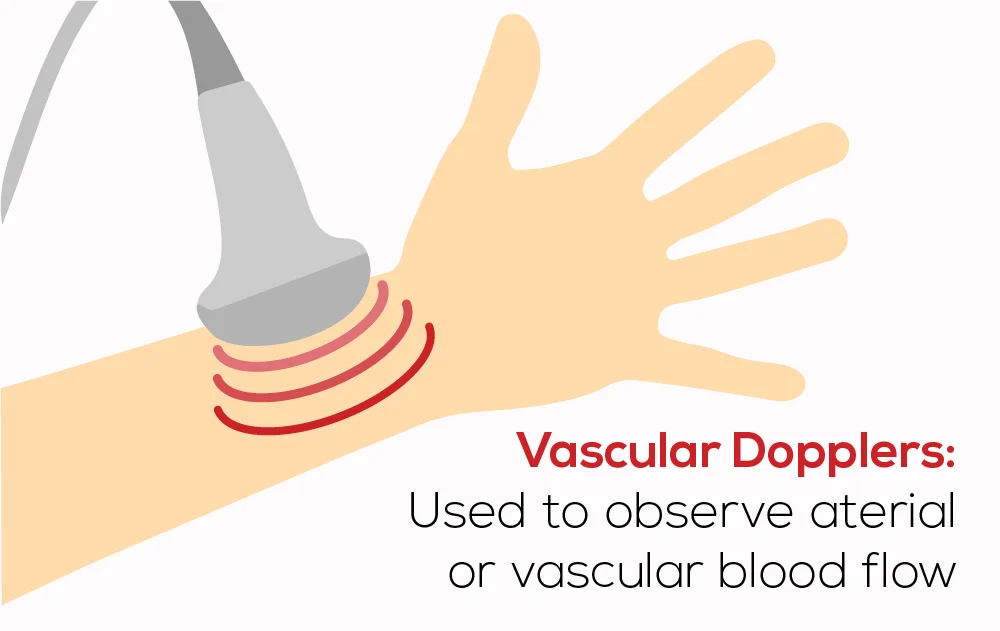 Doppler_Infographic-02