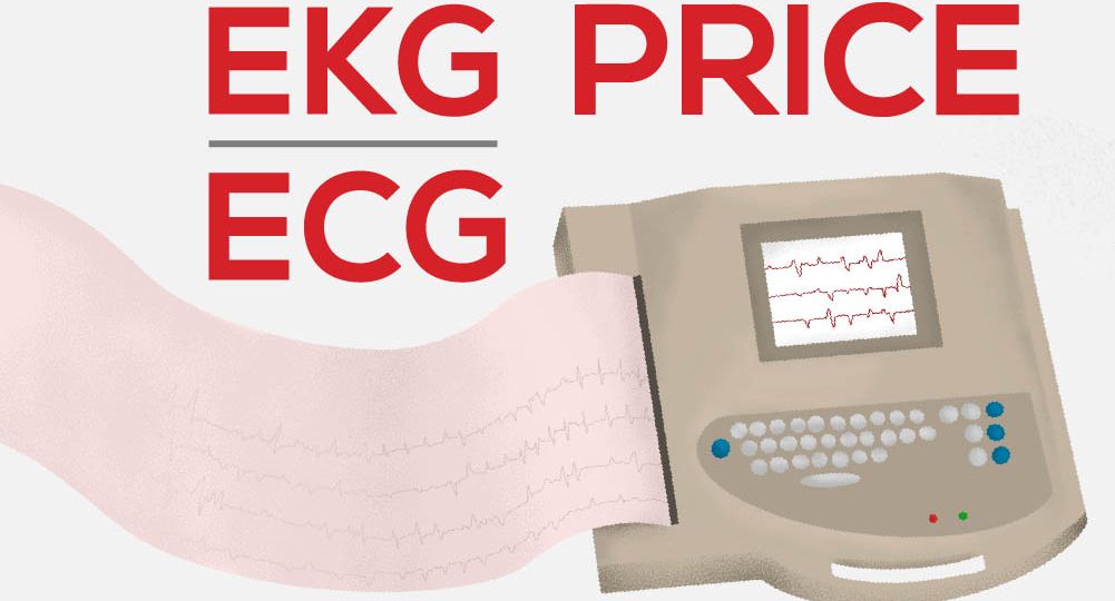 EKG-price_featured-image