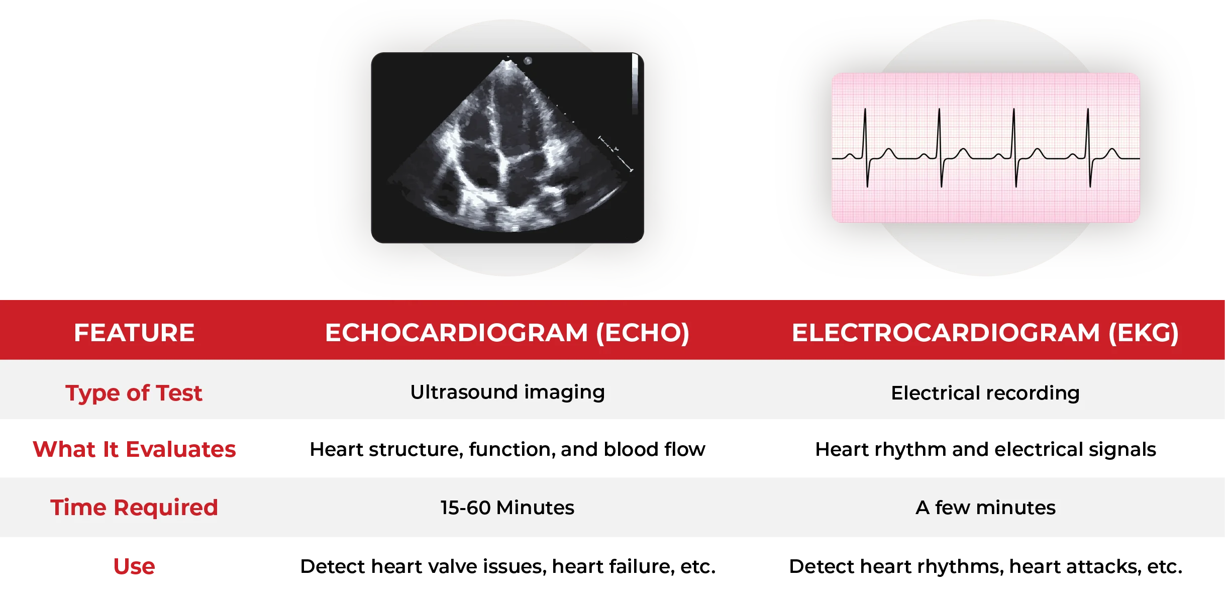 Echocardiogram_vs._EKG-_Whats_The_Difference__Table