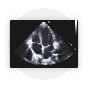 Echocardiogram_vs._EKG-_Whats_The_Difference__copy_Icon_1 Echocardiogram_vs._EKG-_Whats_The_Difference__copy_Icon_1