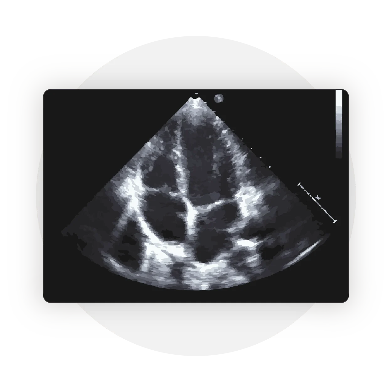 Echocardiogram_vs._EKG-_Whats_The_Difference__copy_Icon_1