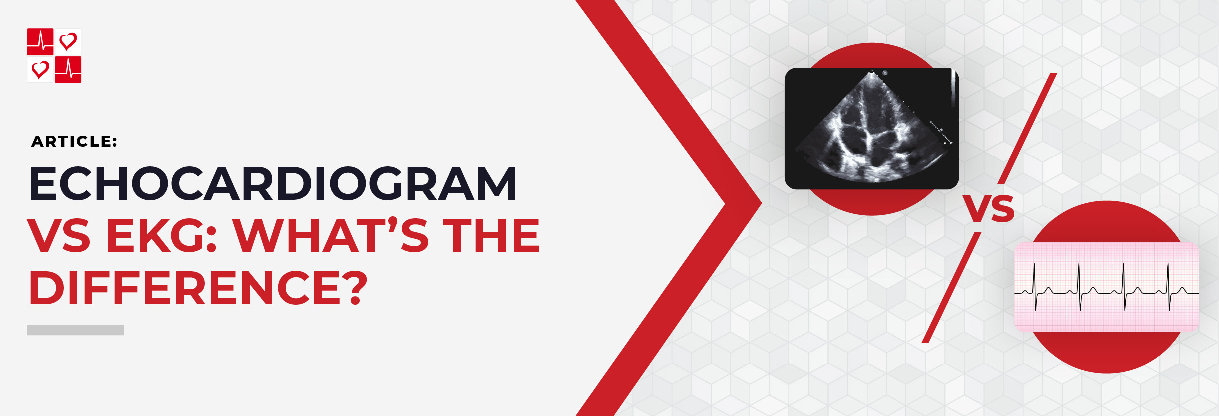 Echocardiogram_vs._EKG-_Whats_The_Difference__copy_Title_Banner