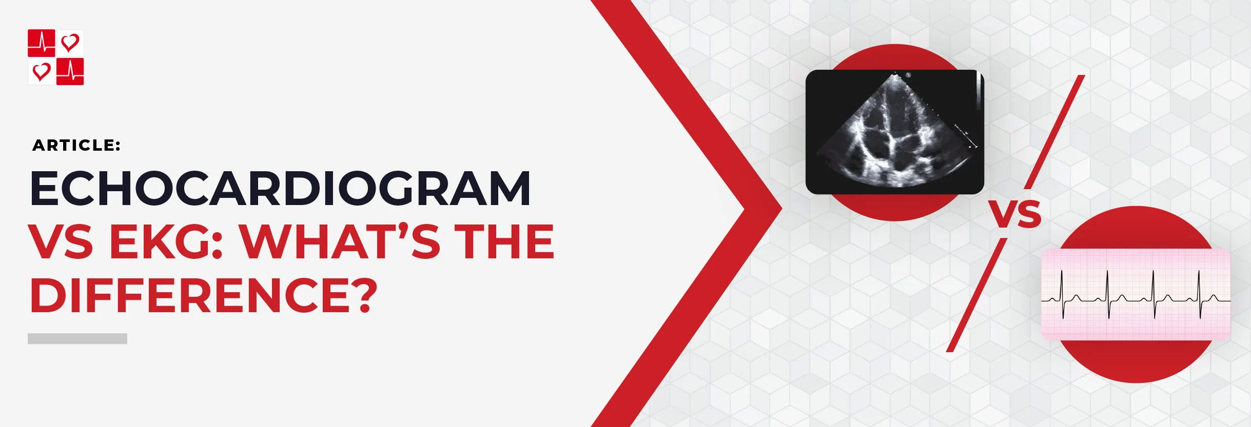 Echocardiogram_vs._EKG-_Whats_The_Difference__copy_Title_Banner