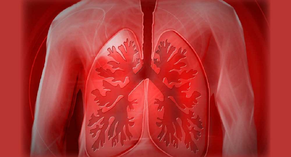 Lung-image-for-cost-of-spirometer-coverfix
