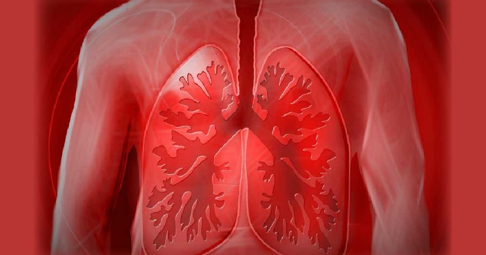Lung-image-for-cost-of-spirometer-coverfix