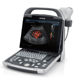 Mindray DP-30 Diagnostic Ultrasound System