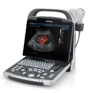Mindray DP-30 Diagnostic Ultrasound System