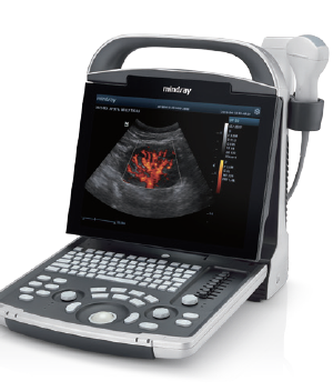 Mindray DP-30 Diagnostic Ultrasound System