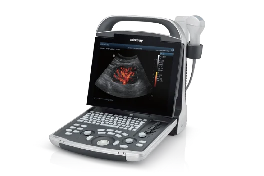 Mindray DP-30 Diagnostic Ultrasound System
