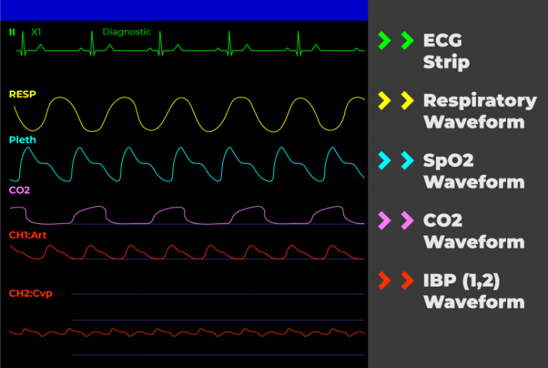 How To Read A Patient Monitor Numbers And Lines Explained