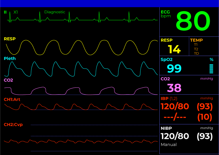 patient-monitor-screen