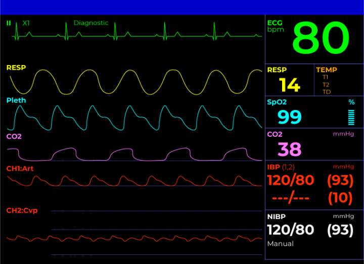 Patient Monitor Displays Vital Signs Ecg Electrocardiogram Ekg Oxygen ...