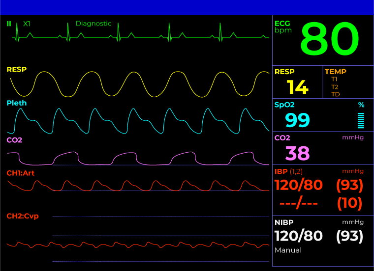 Patient Monitors, Vital Signs Monitor, EKG Monitor