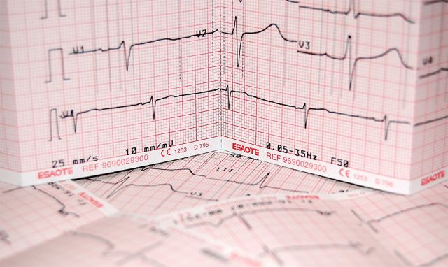 Featured-img-ekg-strip-blog
