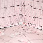 Featured-img-ekg-strip-blog