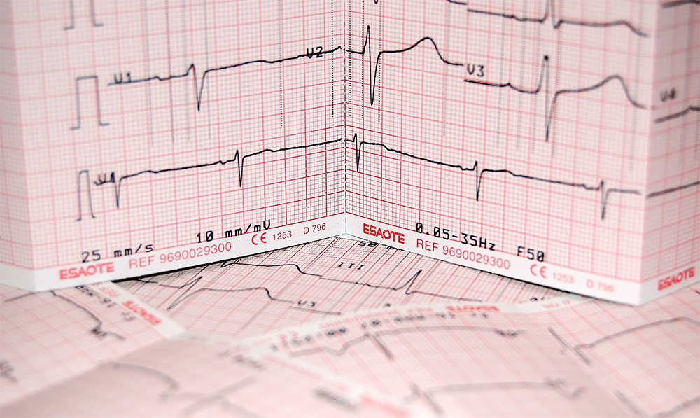 Featured-img-ekg-strip-blog