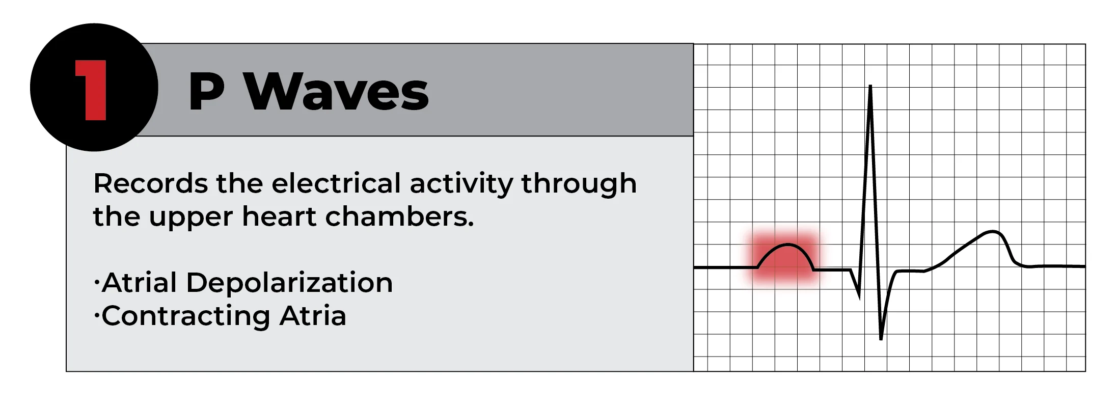 reading-ekg-strip-working-file-02