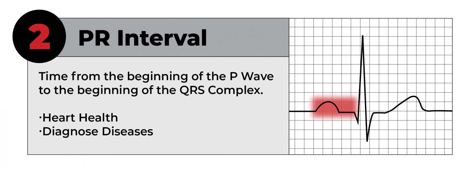 How to Read an EKG Strip in 5 Steps CardiacDirect