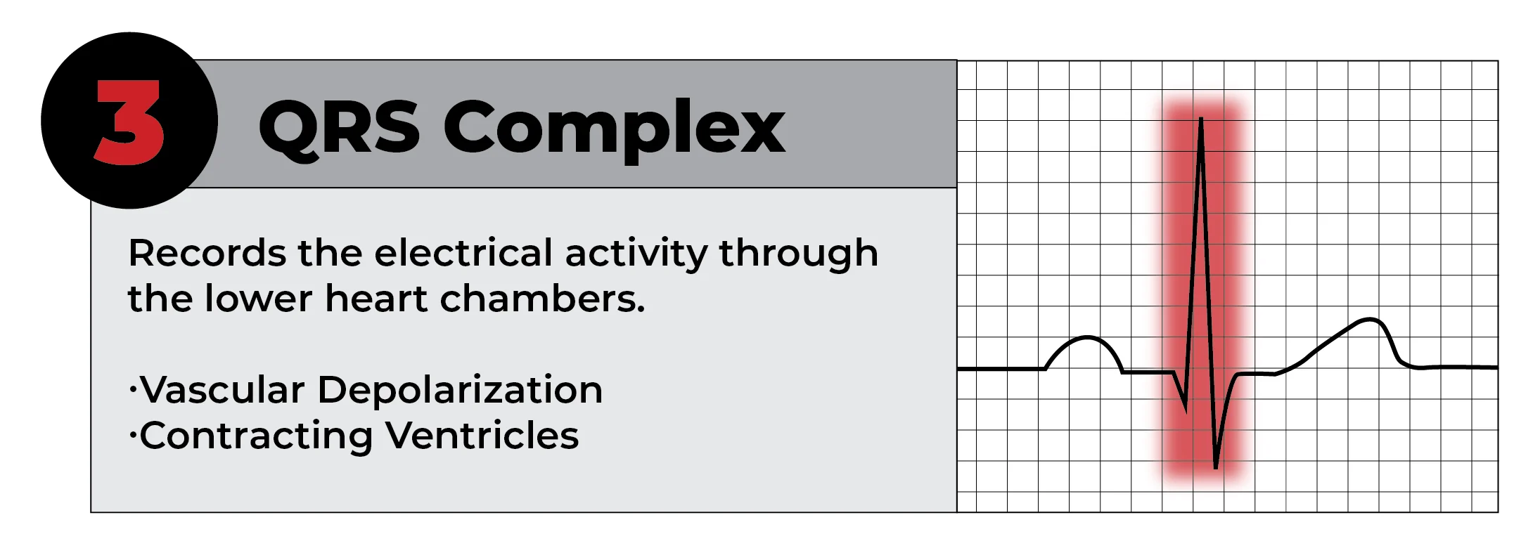 reading-ekg-strip-working-file-04