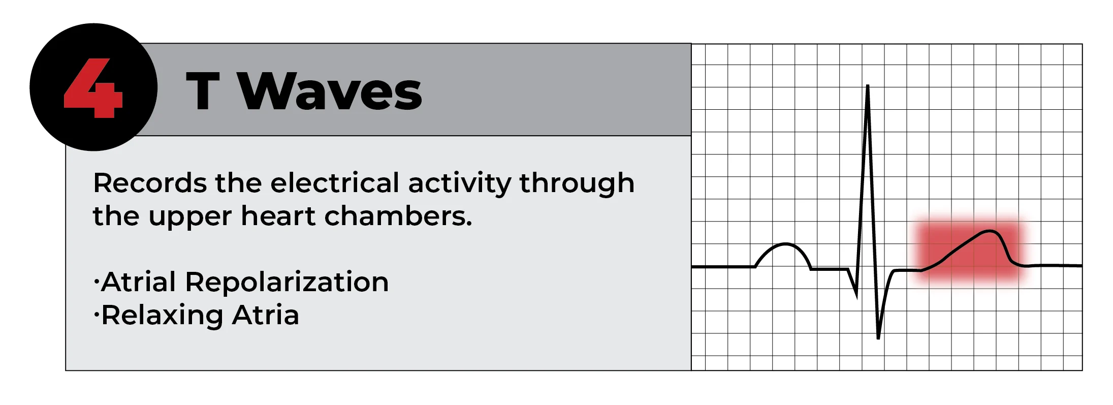 reading-ekg-strip-working-file-05