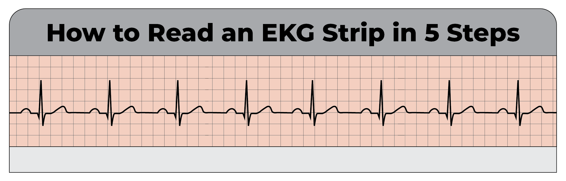 How to Read an EKG Strip in 5 Steps - CardiacDirect