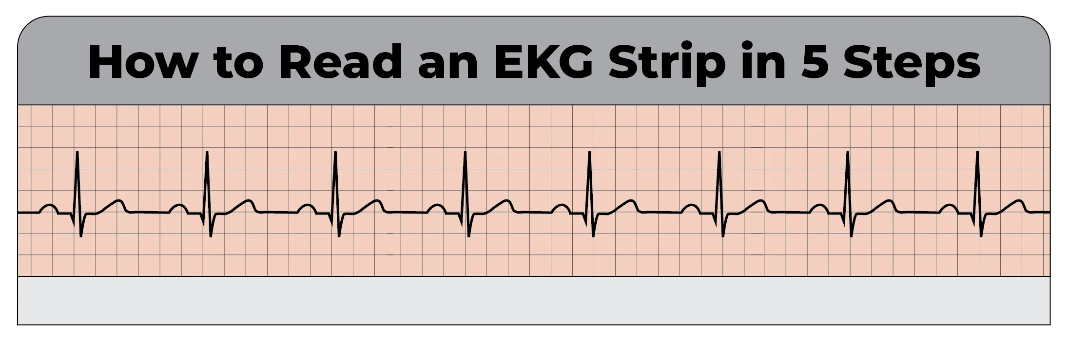 reading-ekg-strip-working-file-06
