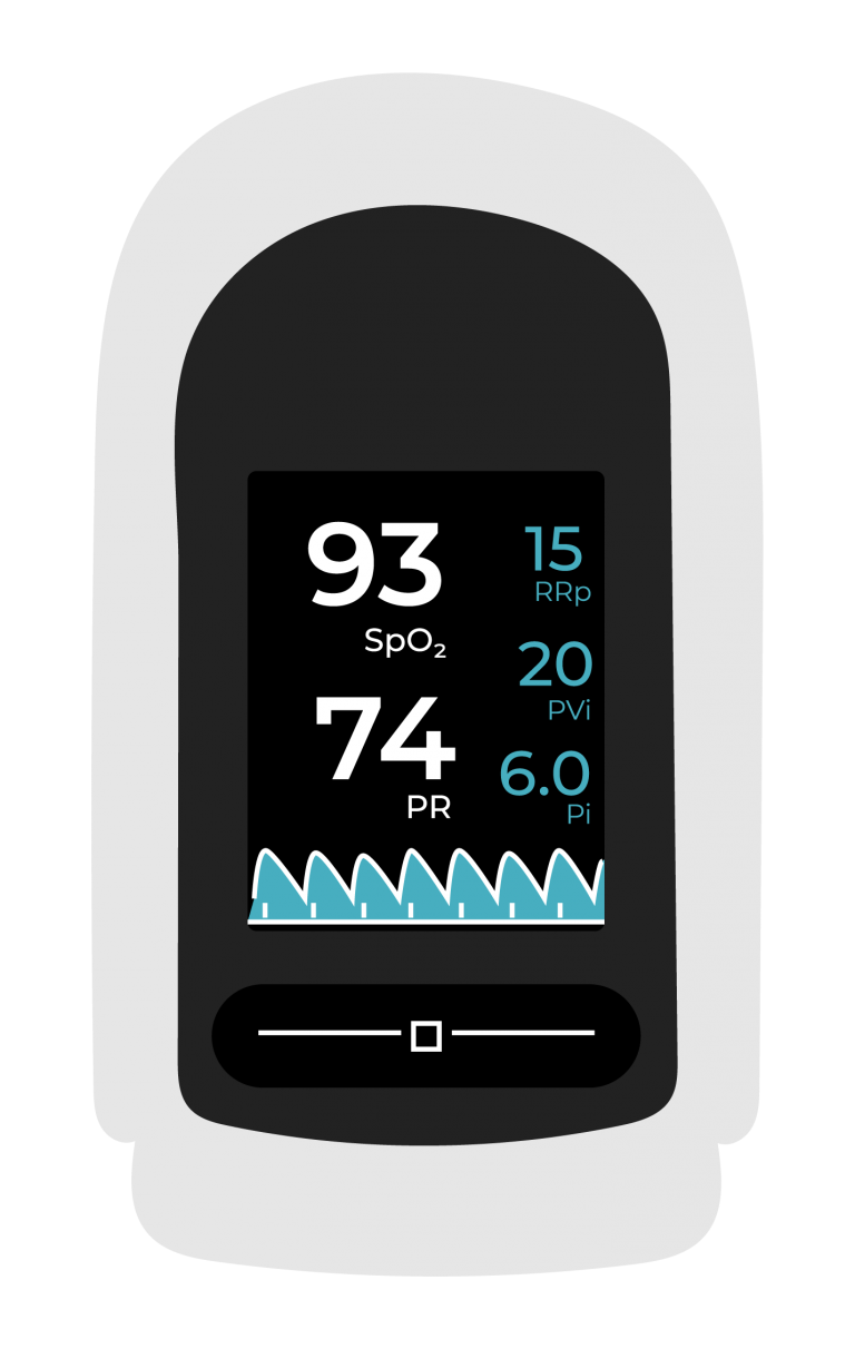 What is Perfusion Index in a Pulse Oximeter? CardiacDirect