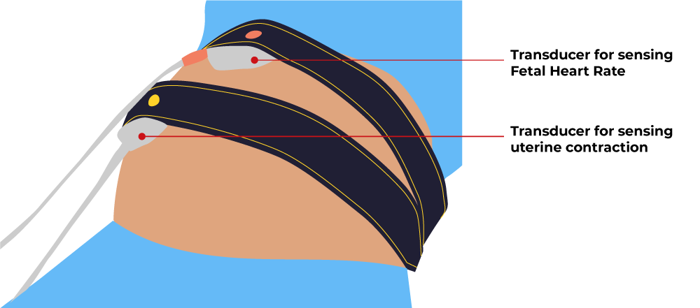 non-stress-test-illustration-text