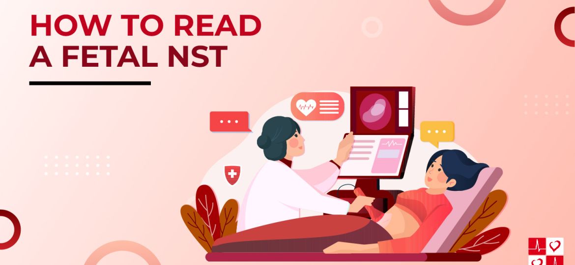 How-to-Read-Fetal-NST_TitleGraphic