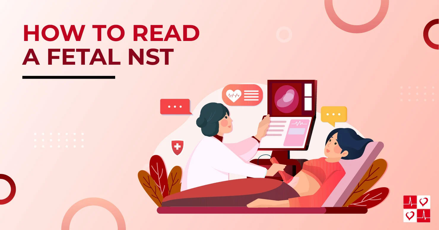 How-to-Read-Fetal-NST_TitleGraphic