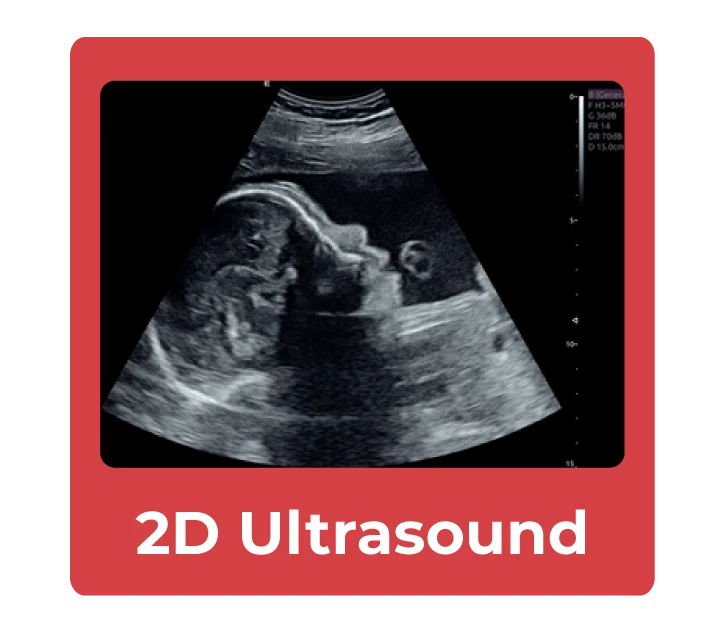2d-ultrasound-compare