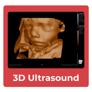 3d-ultrasound-compare