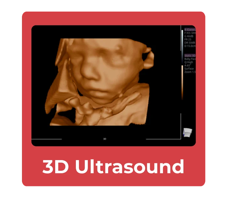 3d-ultrasound-compare