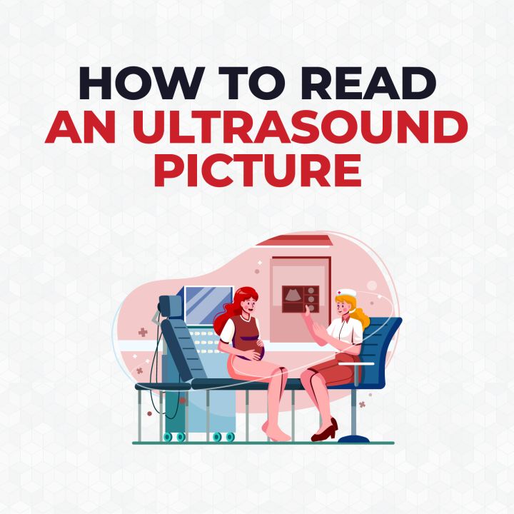 How to Read an Ultrasound Picture CardiacDirect
