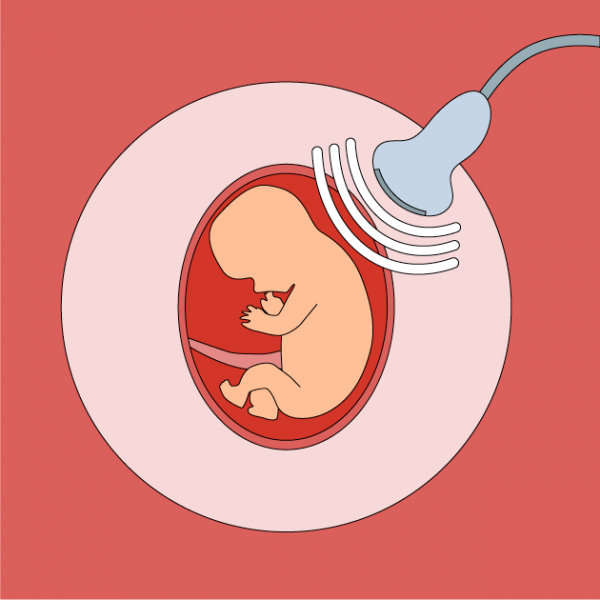 probe-ultrasound-graphic