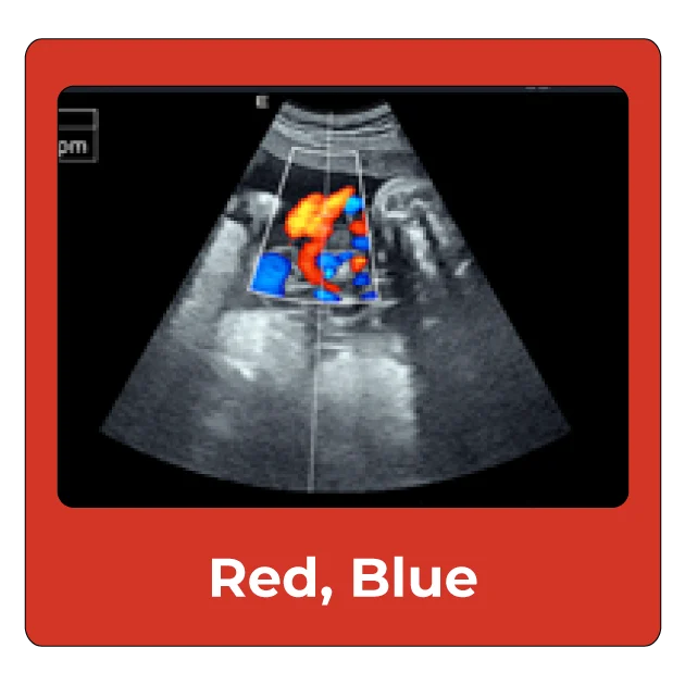 red-blue
