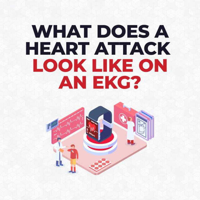 Heart-Attack-on-EKG-400x400