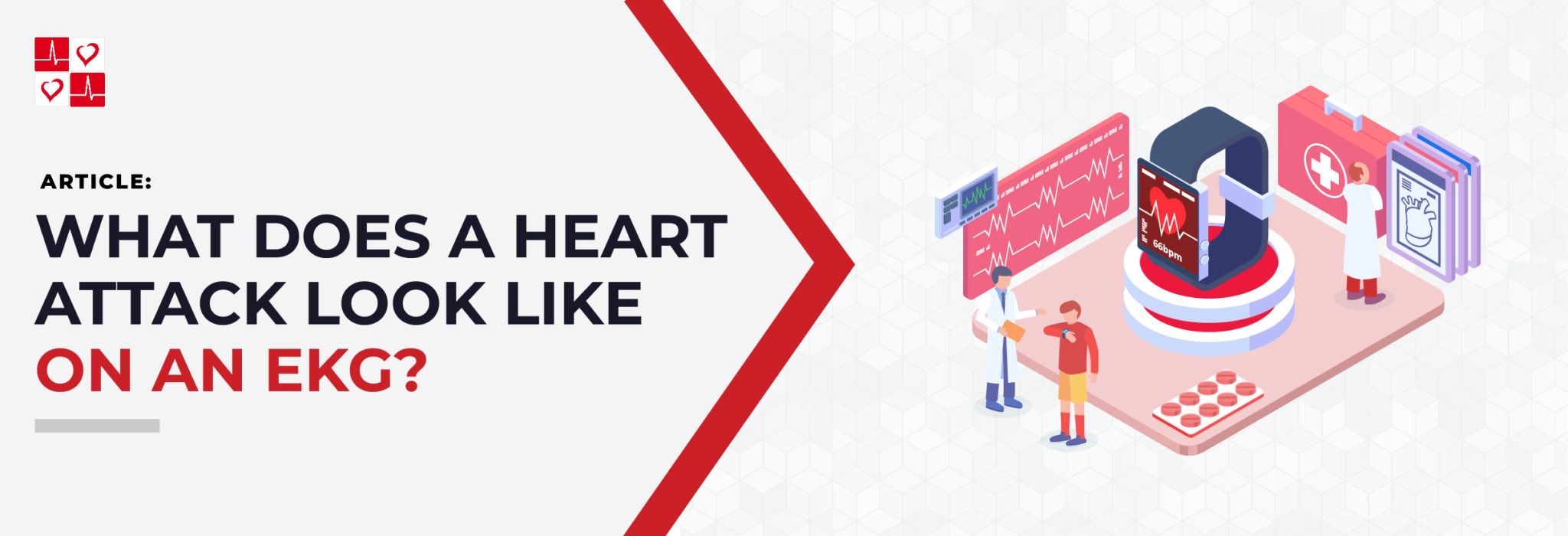 What does a Heart Attack look like on an EKG? CardiacDirect