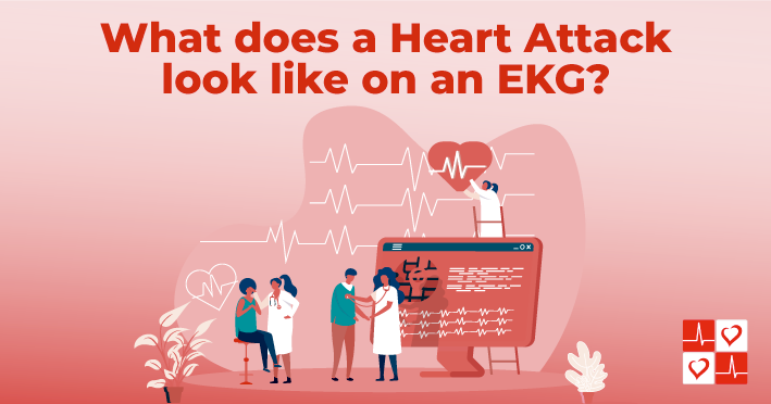 main-graphic-heart-attack-on-EKG
