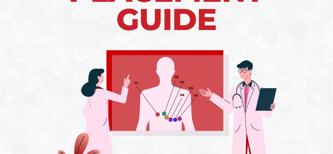 12-Lead-ECG-Placement-400x400