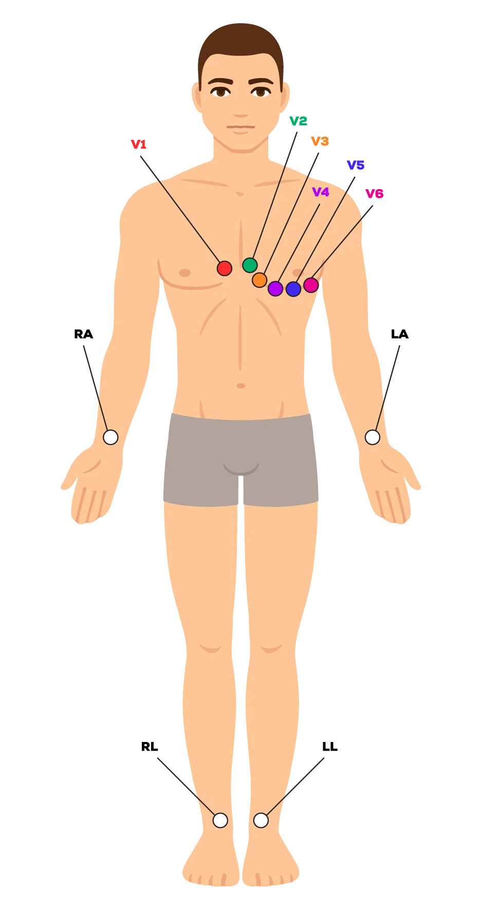 12-LeadECGPlacement_AdditionalGraphic (1)