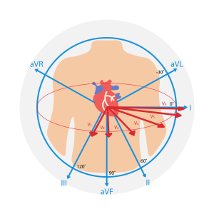 ECG_Placement-02 ECG_Placement-02
