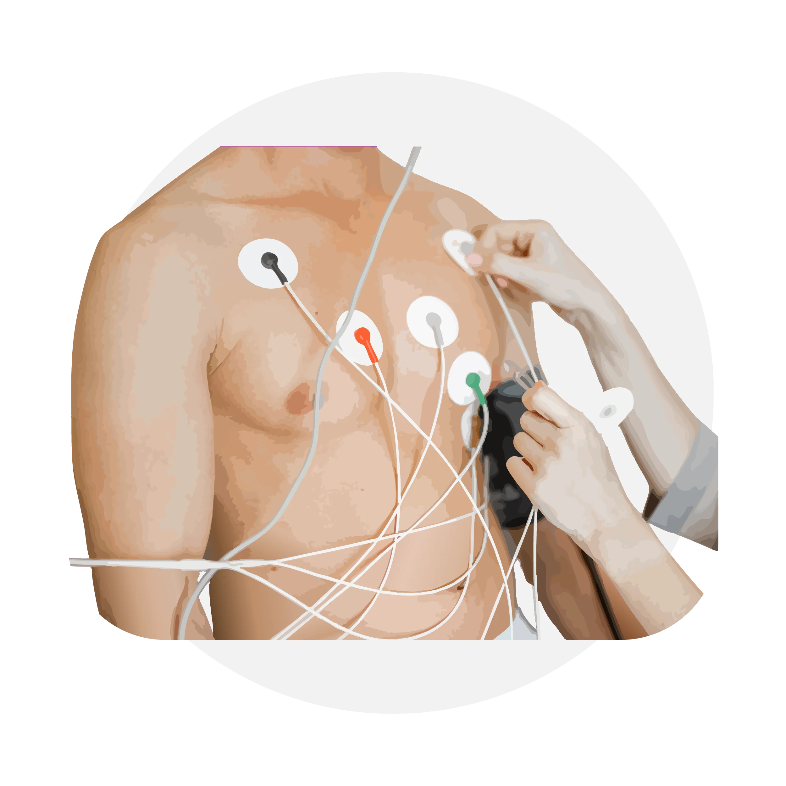 ECG_Placement_Icon