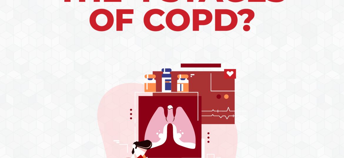 4-Stages-COPD-400x400