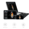Youkey Soloscan P50 Ultrasound Scanner