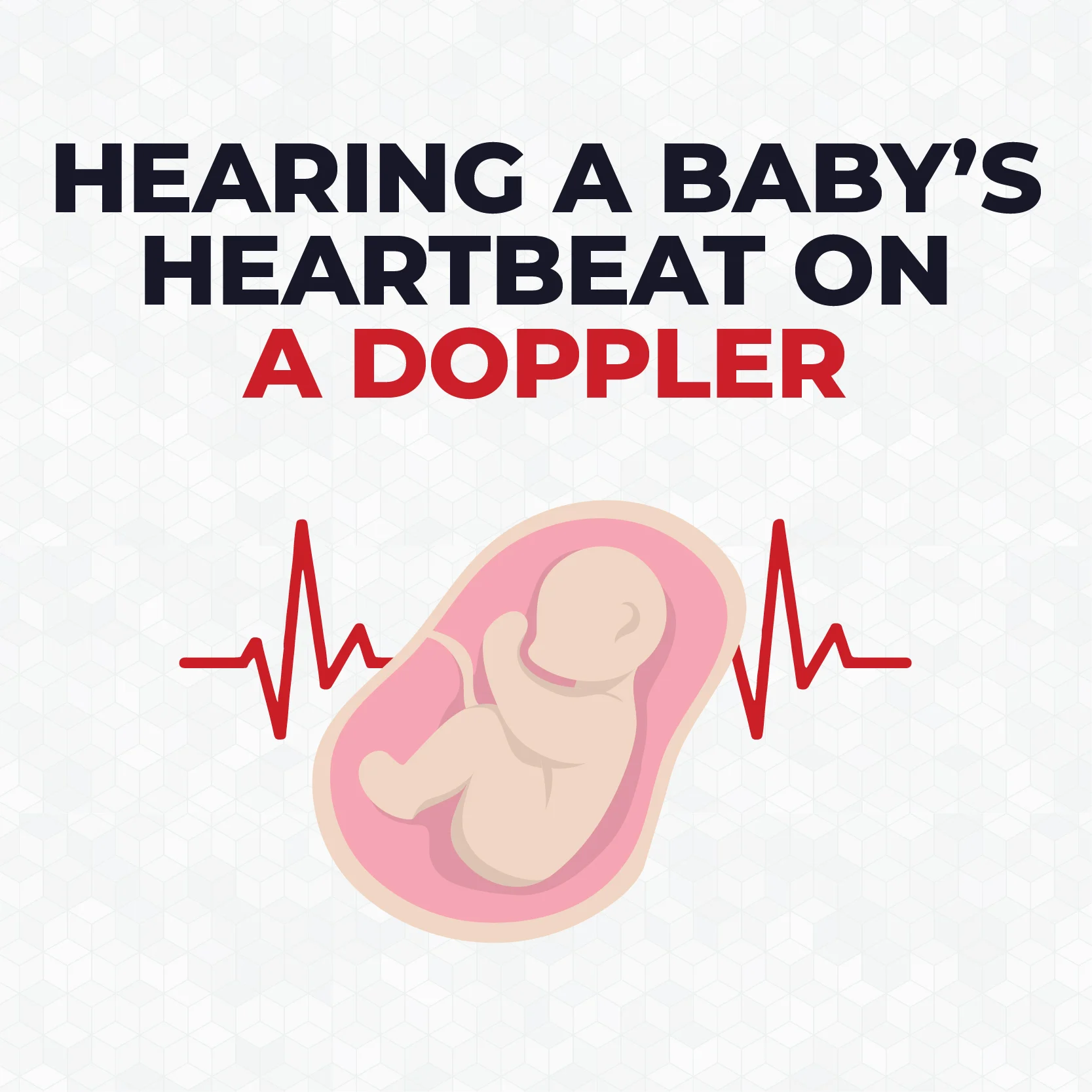 Babys-Heartbeat-Fetal-Doppler-400×400
